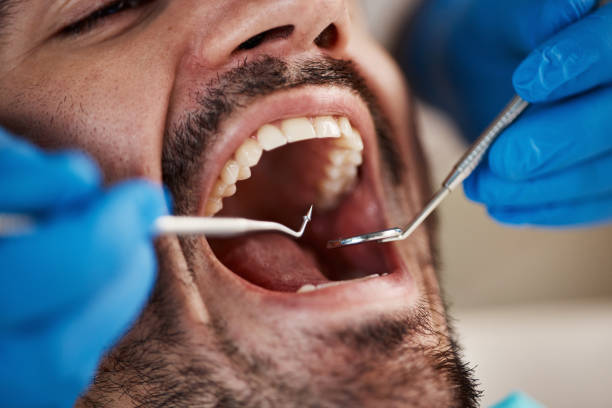 Best Emergency TMJ Treatment in Smithville Sanders, IN